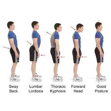 Royal Posture Corrector