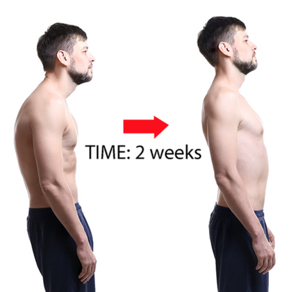 Adjustable Magnetic Posture Corrector